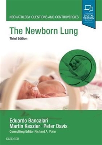 Portada del libro The Newborn Lung