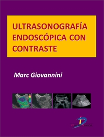 Portada del libro Ultrasonografía endoscópica con contraste