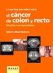 Portada del libro Lo que hay que saber sobre el cáncer de colon y recto