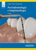 Portada del libro Periodontología e Implantología (+ e-book)