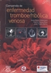 Portada del libro Compendio de enfermedad tromboembólica venosa