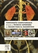 Portada del libro Tomografía computarizada dirigida a técnicos superiores en imagen para el diagnóstico